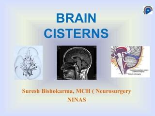 Basal Cisterns Anatomy