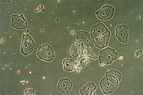 Squamous Epithelial Cells Photograph by Perennou Nuridsany