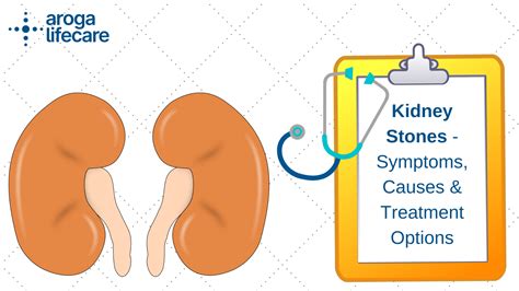 causes of kidney stones - causes of kidney stonescauses of kidney stones