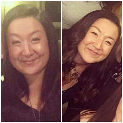 F/33/5'1 [215 lbs > 170 lbs = 45 lbs] (1 year) Slow and steady but seeing just face changes is ...