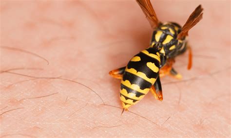 Are Wasp Stings Dangerous? (Our Warning!) | Pests Banned