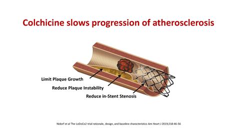 Low dose colchicine gets FDA approval for secondary prevention of heart ...