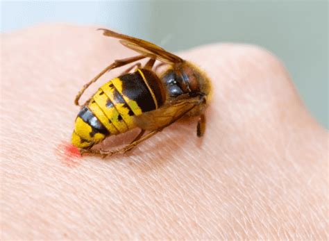 Do Bees And Hornets Have The Same Venom? Chemicals, Pain And Toxicity