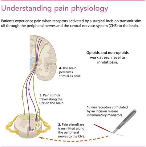 Opioid and non-opioid analgesia during surgery - American Nurse