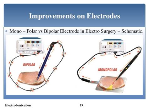 Electrodessication Bio Medical Instrumentation