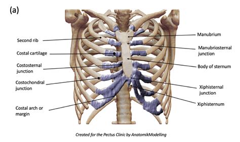 Complex Chest Wall Injury | Rib Injury Clinic