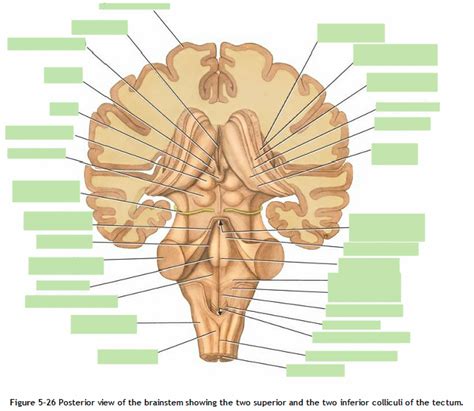 posterior view of brainstem showing superior and inferior colliculi of ...