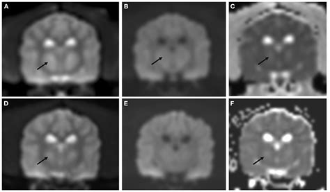 Frontiers | Case report: Recovery and sequential imaging of a patient ...