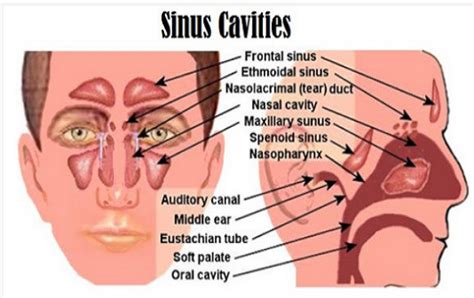 Sinus Infections Caused By Fungus