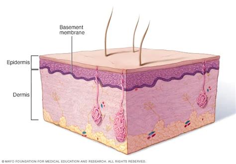 Epidermolysis bullosa - Symptoms and causes (2022)