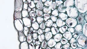 Collenchyma Cells: Function, Definition & Examples - Video & Lesson Transcript | Study.com