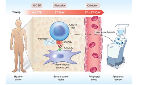 Use of plerixafor to mobilize haematopoietic progenitor cells in healthy donors - Romon - 2022 ...