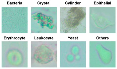 Diagnostics | Free Full-Text | Automatic Classification of Particles in the Urine Sediment Test ...