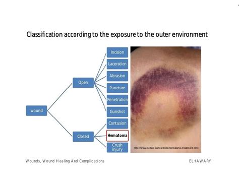 Презентация wounds. wounds healing amp complications