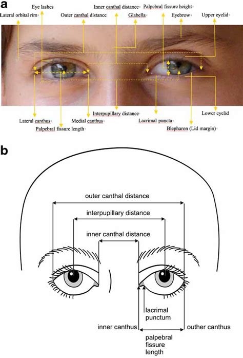 Elements of Morphology: Human Malformation Terminology | Dermatology ...