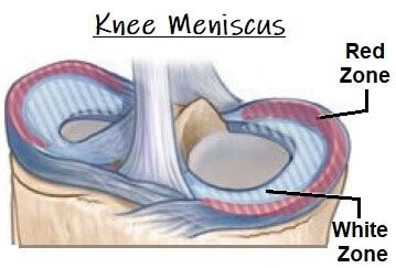 Knee Meniscus: Function & Injuries - Knee Pain Explained