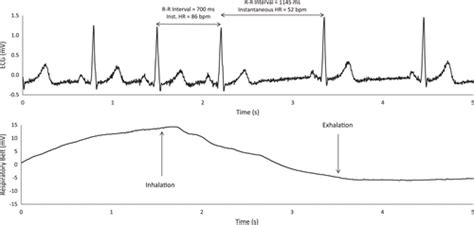 Heart Rate Variability – Intellihinc