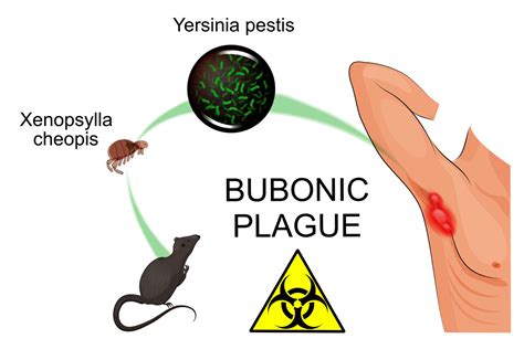 Pathogen of the Month: Yersinia Pestis - GIDEON - Global Infectious Diseases and Epidemiology ...