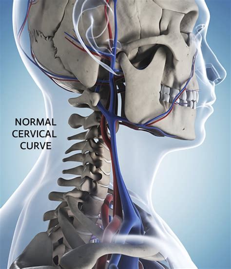 Reverse Cervical Curve - Charlotte Chiropractic Center, PLLC