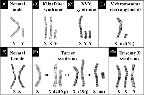 Chromosome Abnormalities List