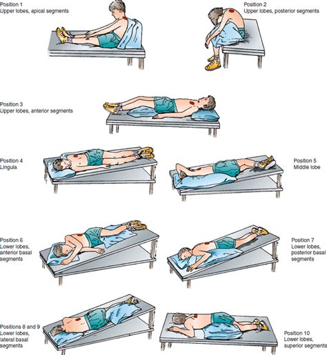 Percussion And Postural Drainage Positions In Bronchiectasis - Best ...