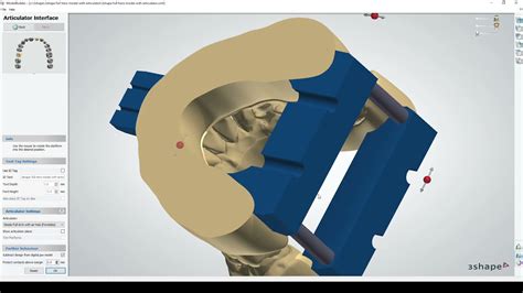 Anti-Cupping 3Shape Articulator in Model Builder - Formlabs Dental - Form 3B - YouTube