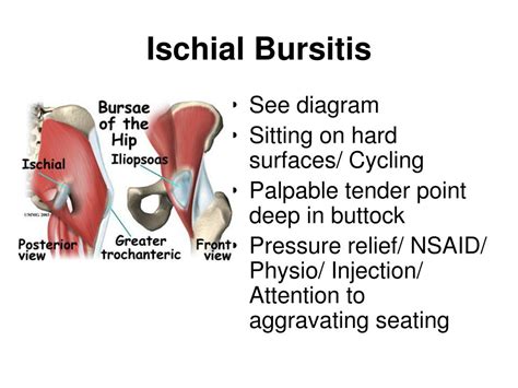 PPT - Trochanteric Bursitis PowerPoint Presentation, free download - ID:1209260