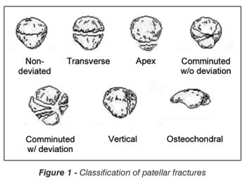 Patella Fracture Classification