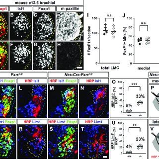 Paxillin function is required for the fidelity of LMC motor axon limb... | Download Scientific ...