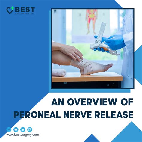 Peroneal-nerve-release