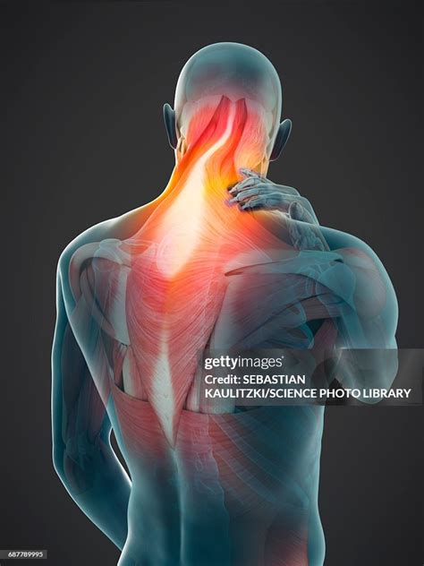 Human Neck Pain Illustration High-Res Vector Graphic - Getty Images