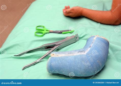 Child with arm cast stock photo. Image of fractured, orthopedic - 39386584