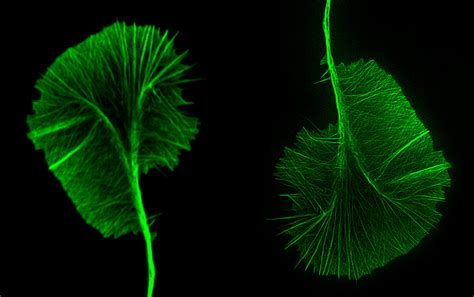 Actin meshwork of an identical growth cone | Nikon Small World