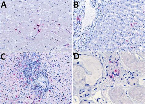 Viral immunostaining of samples from a fatal case of heartland virus... | Download Scientific ...