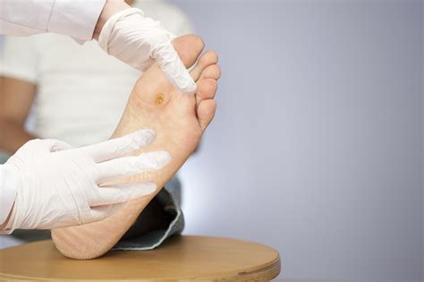 Study Suggests Possible Link Between Diabetic Foot Ulcers, Diminished Cognitive Function ...