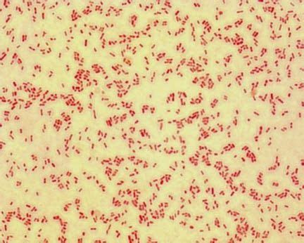 Kết quả hình ảnh cho e.coli nhuộm gram | Hình ảnh