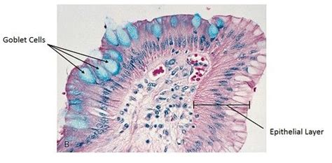 Goblet Cells And Asthma