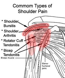 Shoulder Pain - Massage Therapy in Kalbaskraal