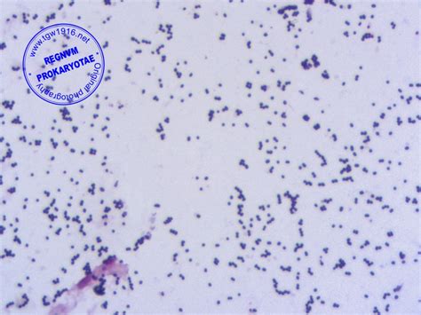 Enterococcus Faecalis Gram Stain Morphology