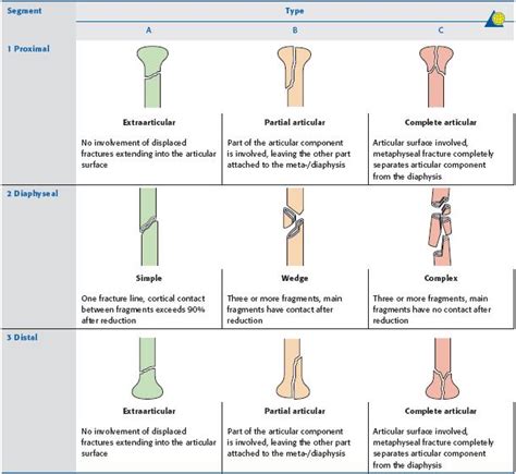 Distal Tibia Fracture Classification