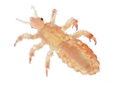 Head Louse Photograph by Sebastian Kaulitzki/science Photo Library - Pixels