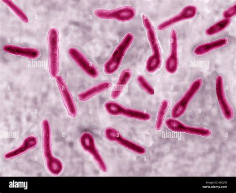 Clostridium Tetani Symptoms