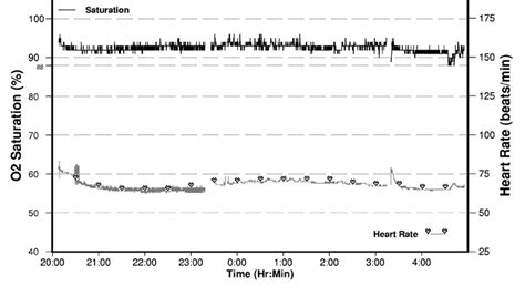 Overnight Pulse Oximetry And Its Use In The Diagnosis Of, 46% OFF