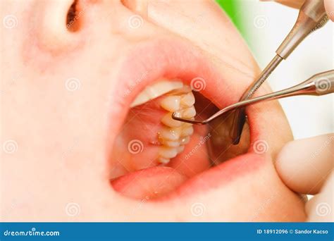 Dental Examination stock photo. Image of medical, examination - 18912096