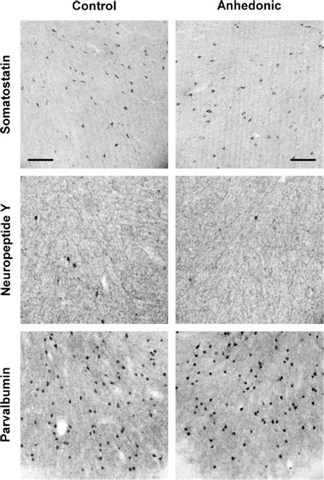 Representative photomicrographs of the different subtypes of GABAergic ...