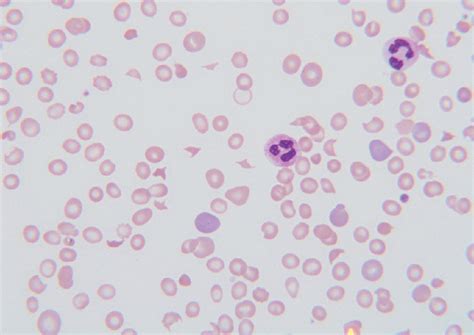 sample case studies – ONCO Pathology Diagnostic Center