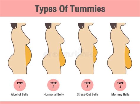 Types Of Tummies For Women. Overweight Woman Illustration de Vecteur - Illustration du isolement ...