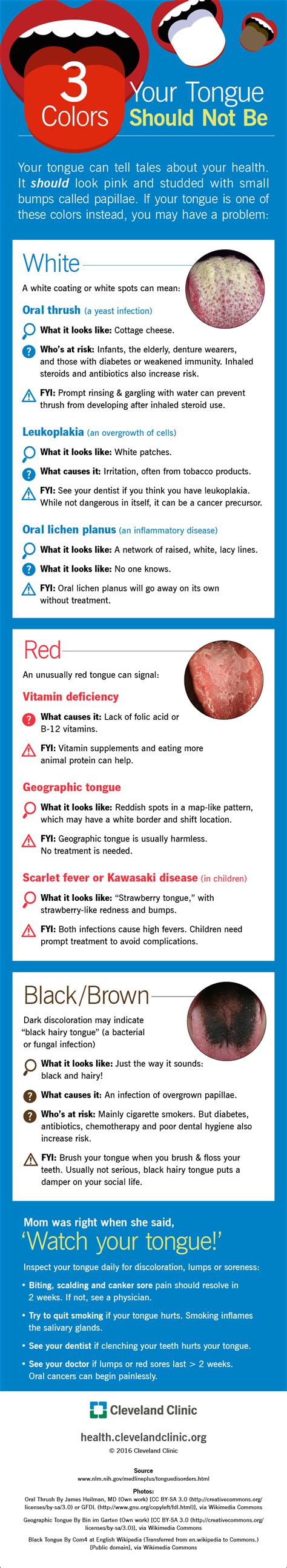 Tongue Health: Color Differences - Medivizor