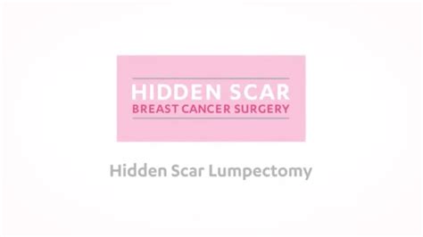 Hidden Scar Lumpectomy Informative Animation - YouTube