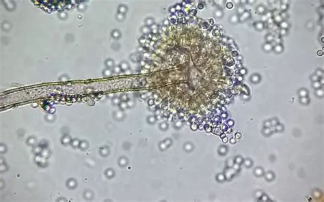 Labelled Aspergillus Niger Under Microscope